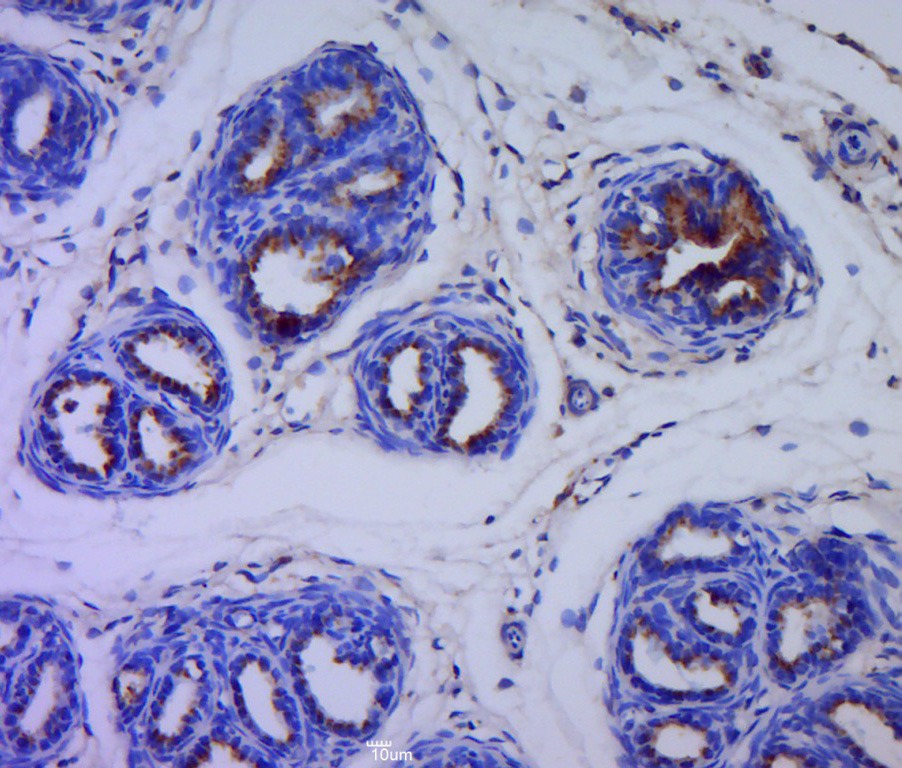 Anti-Cytokeratin 5 Polyclonal Antibody