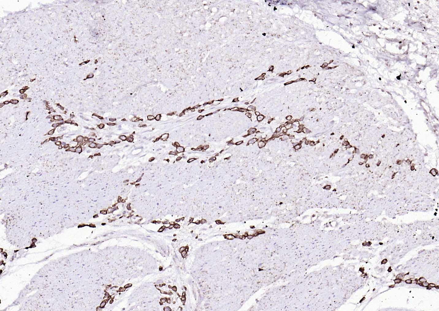 Anti-Cytokeratin 8 Antibody (5G219)