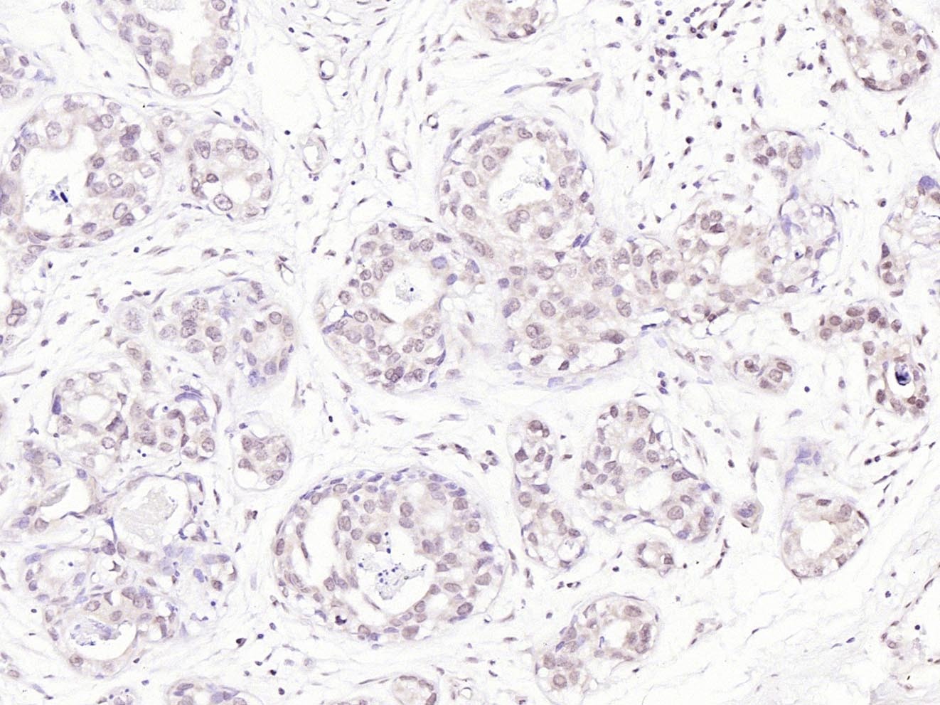 Anti-FAK Polyclonal Antibody