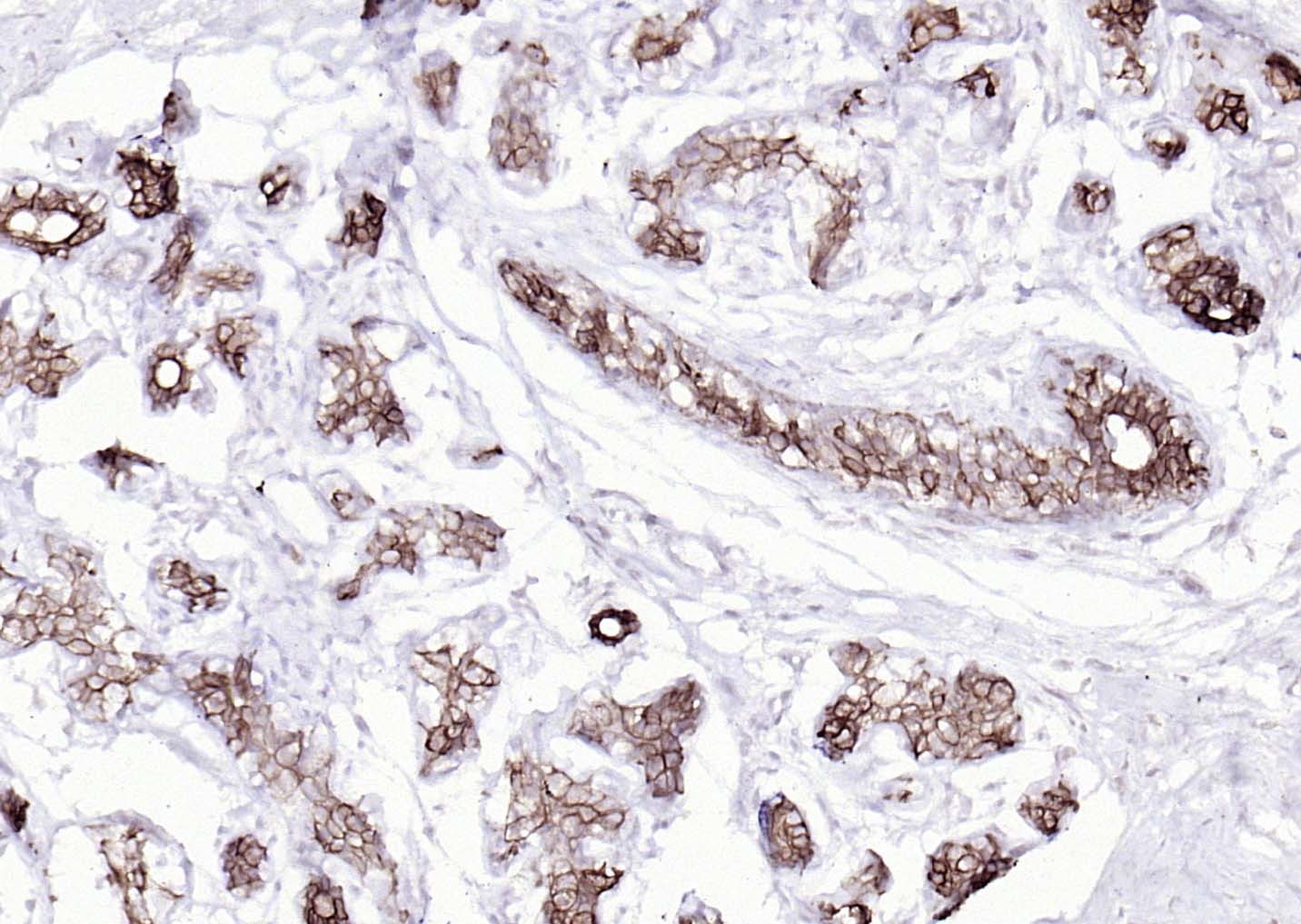 Anti-Cytokeratin 8 Antibody (5G219)