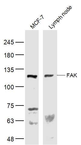Anti-FAK Polyclonal Antibody 2
