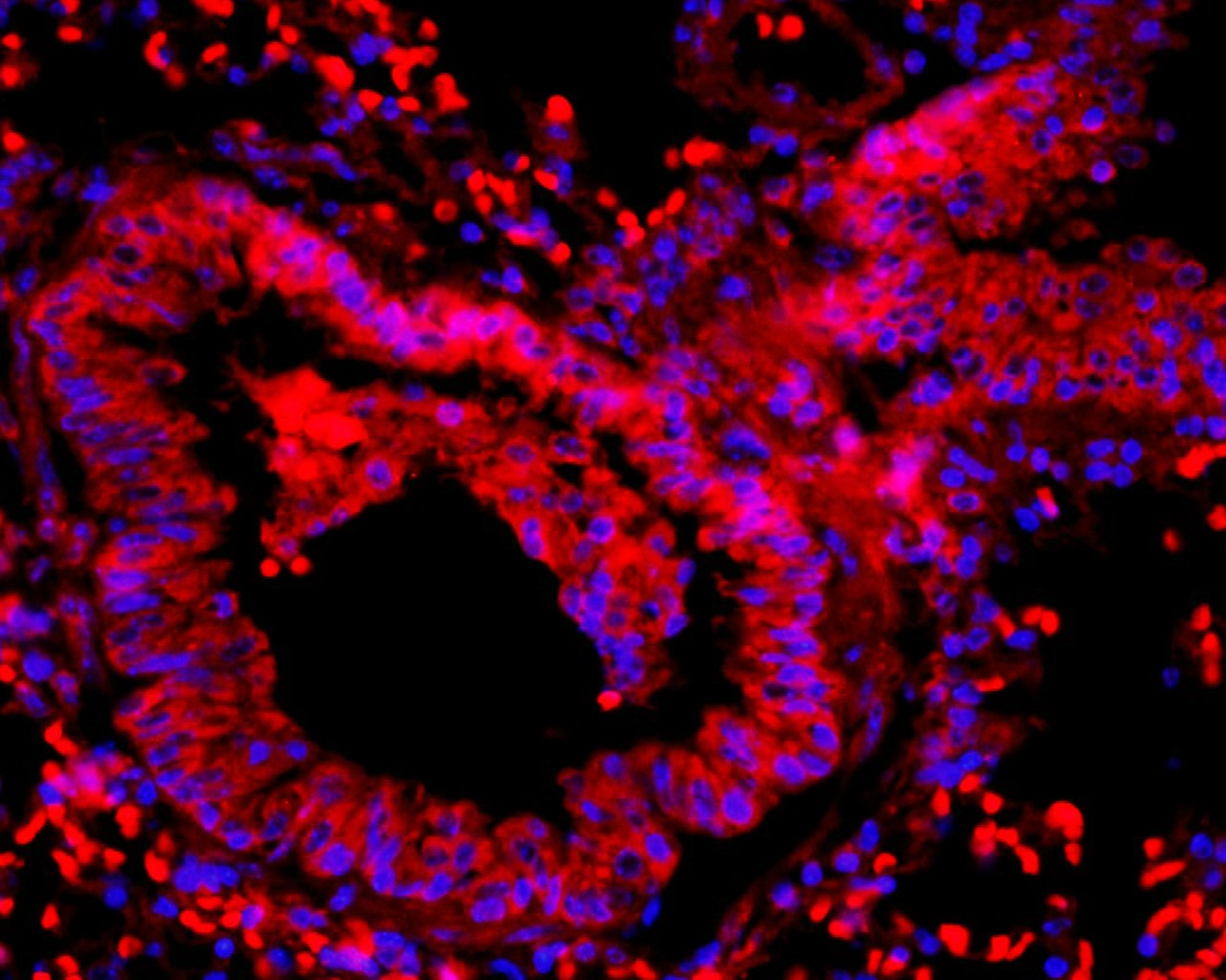 Anti-FAK Polyclonal Antibody