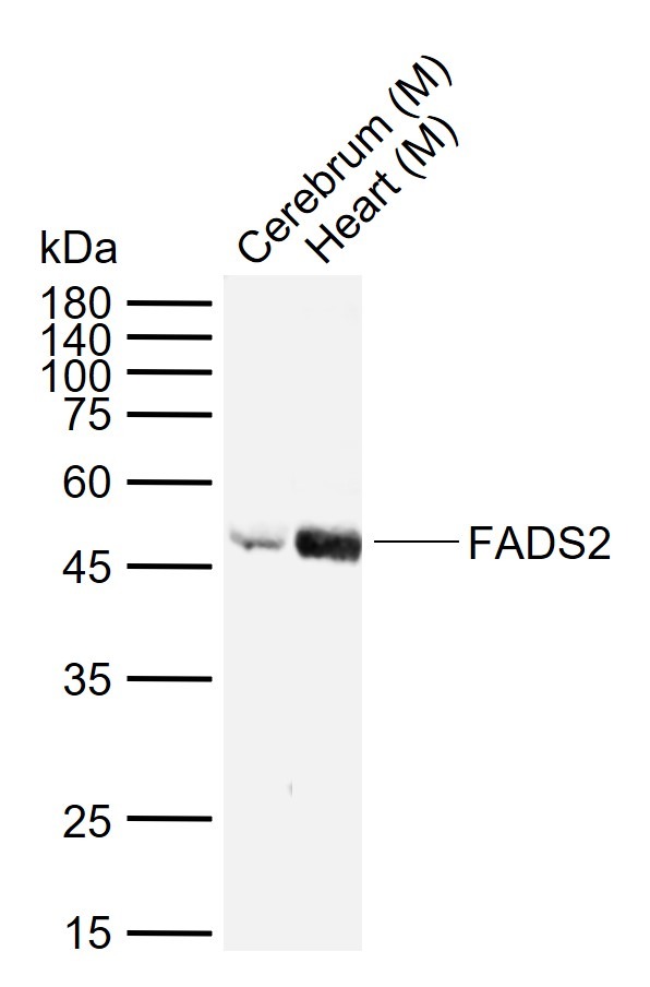 Anti-FADS2 Polyclonal Antibody