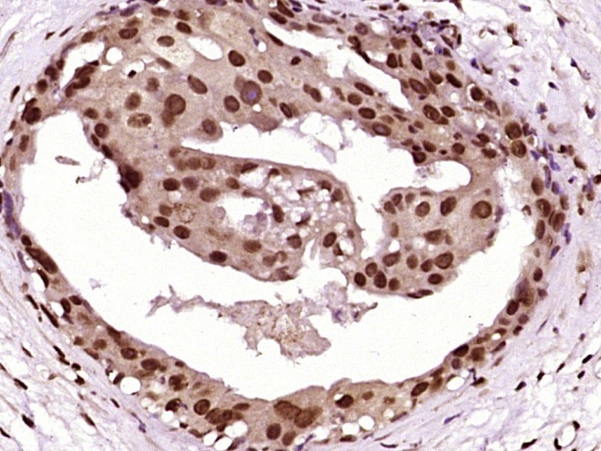 Anti-Cytokeratin 5 Polyclonal Antibody