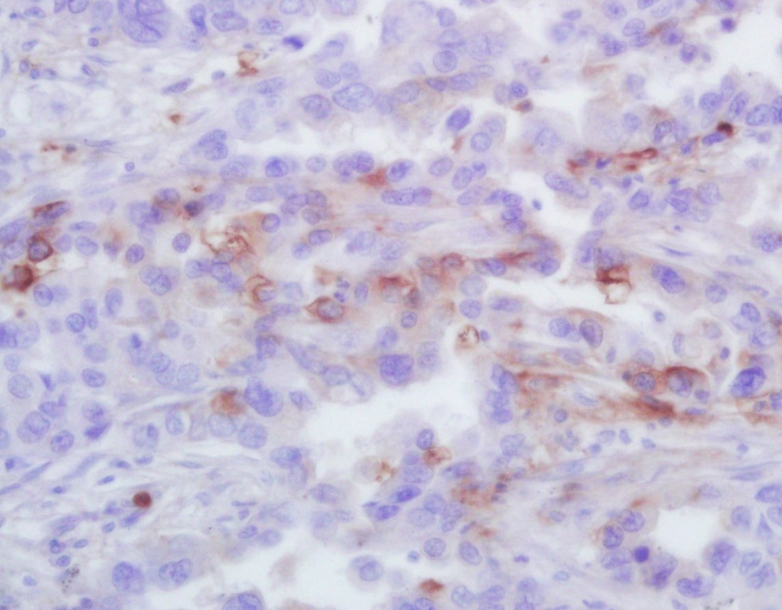 Anti-CXCL1 Polyclonal Antibody