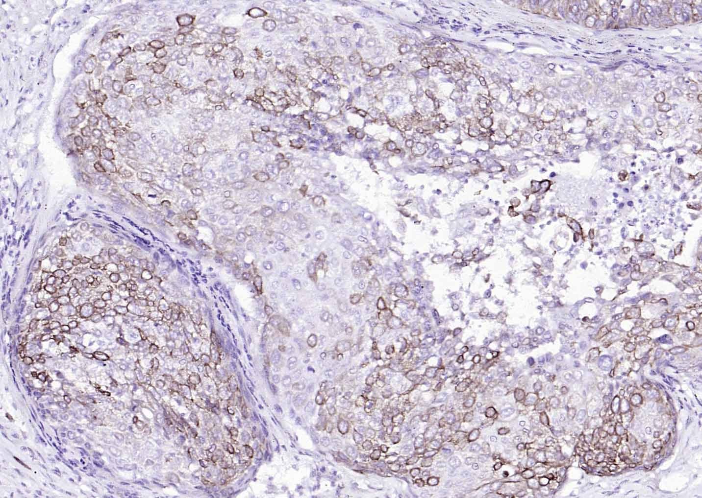 Anti-Cytokeratin 8 Antibody (5G219)