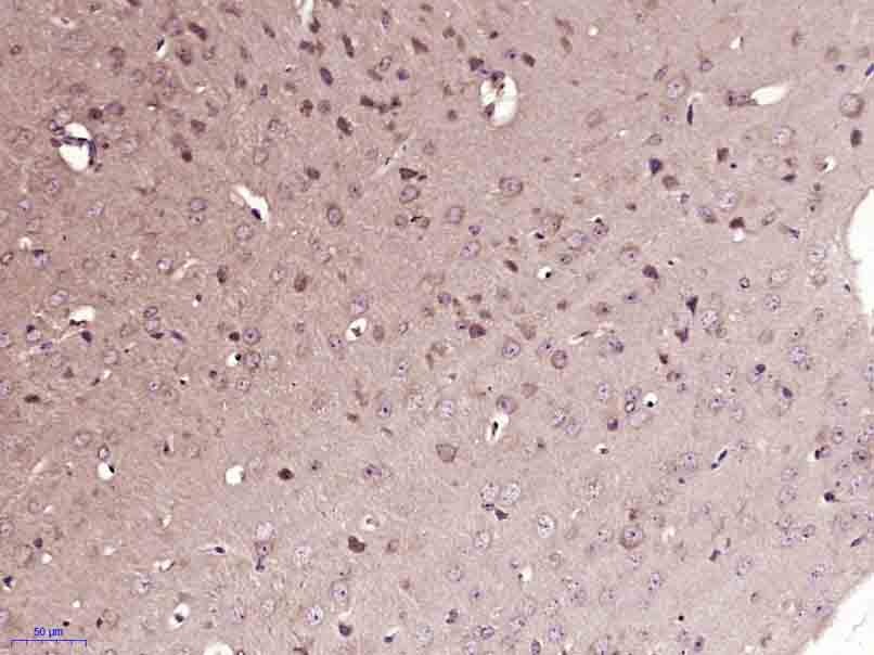 Anti-FAK Polyclonal Antibody