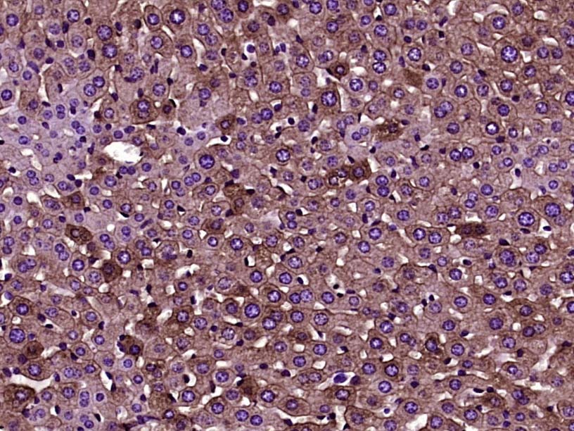 Anti-Cytokeratin 8 Antibody (5G219)