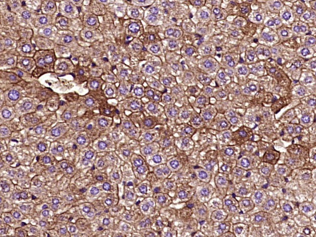 Anti-Cytokeratin 8 Antibody (5G219)