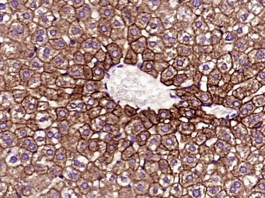 Anti-Cytokeratin 8 Antibody (5G219)
