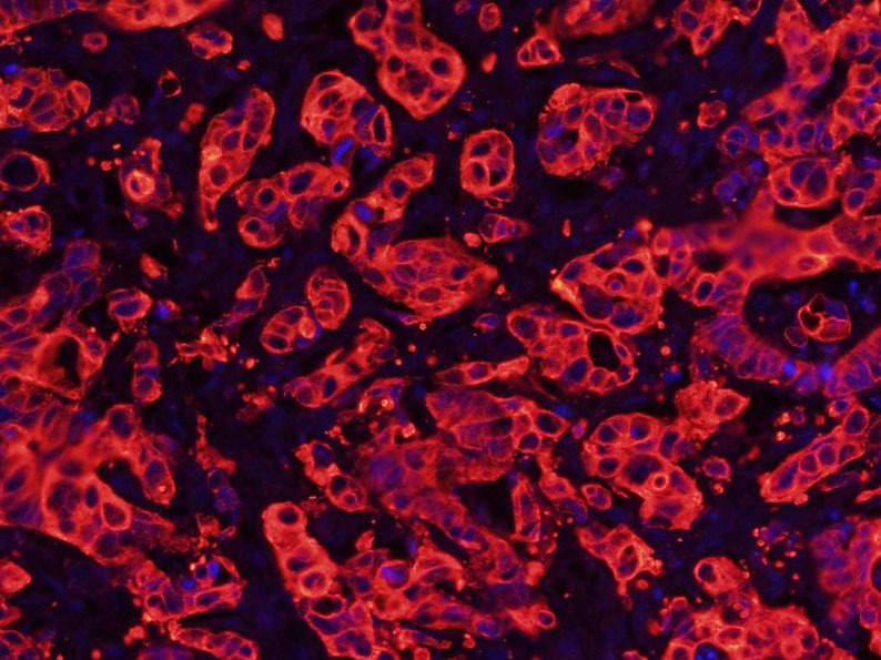 Anti-Cytokeratin 8 Antibody (5G219)