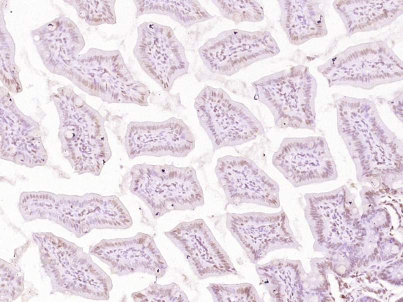 Anti-ESCO2 Polyclonal Antibody