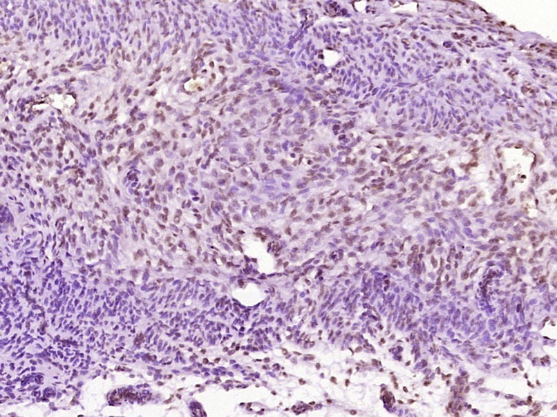 Anti-ERR1 Polyclonal Antibody