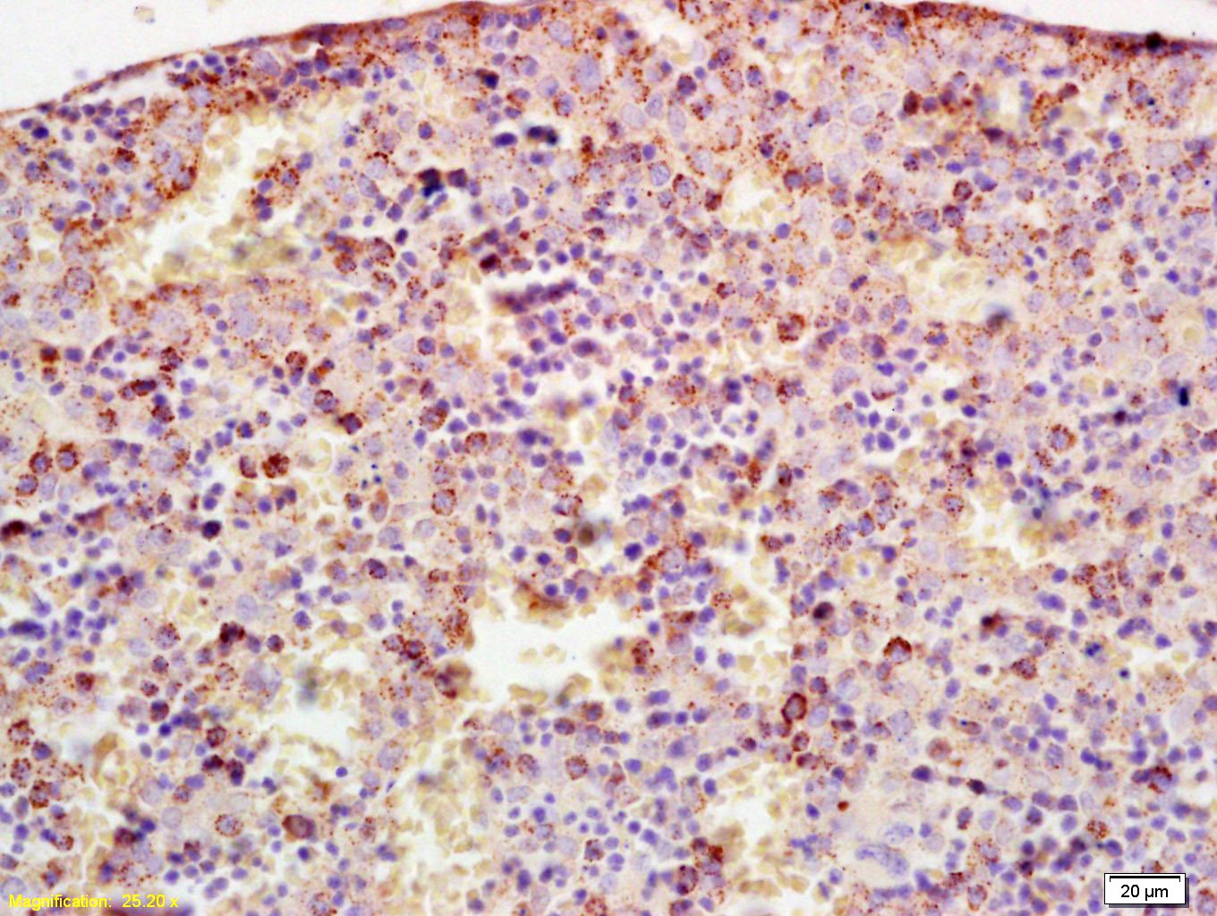 Anti-CYP17A1 Polyclonal Antibody