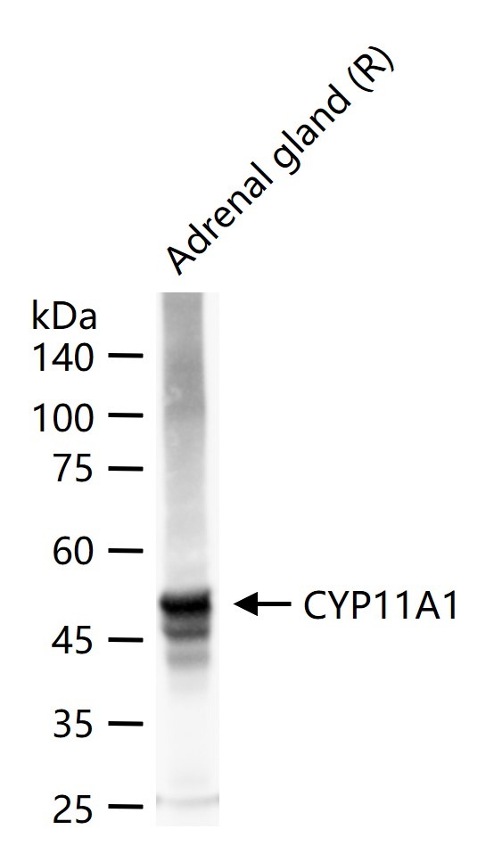 Anti-CYP11A1 Polyclonal Antibody 2