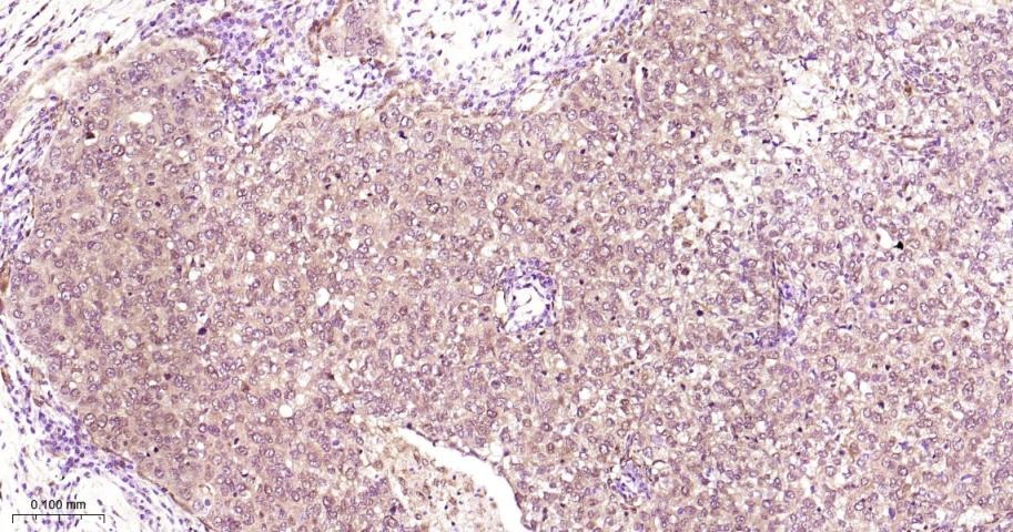 Anti-ERK1/2 Antibody (6Q27)