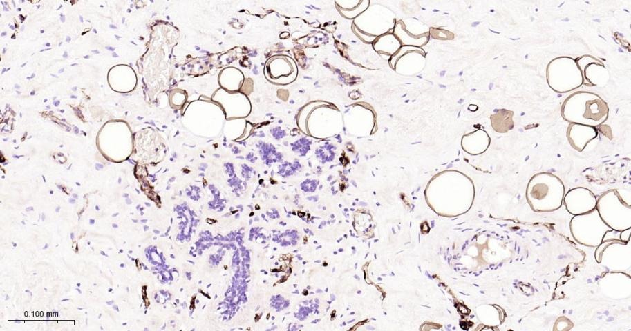 Anti-FABP4 Antibody (5W917)