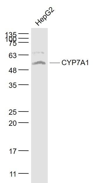 Anti-CYP7A1 Polyclonal Antibody 2
