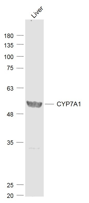 Anti-CYP7A1 Polyclonal Antibody 2