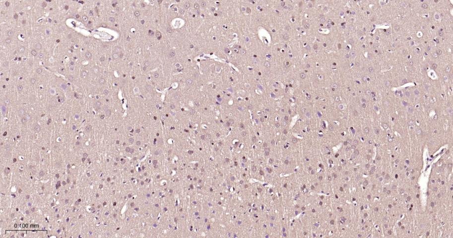 Anti-ERK1/2 Antibody (6Q27)