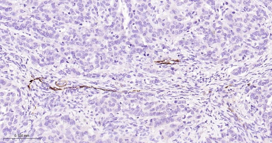 Anti-FABP4 Antibody (5W917)