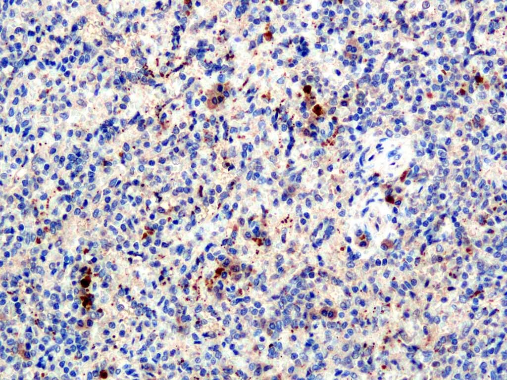 Anti-CXCL1 Polyclonal Antibody