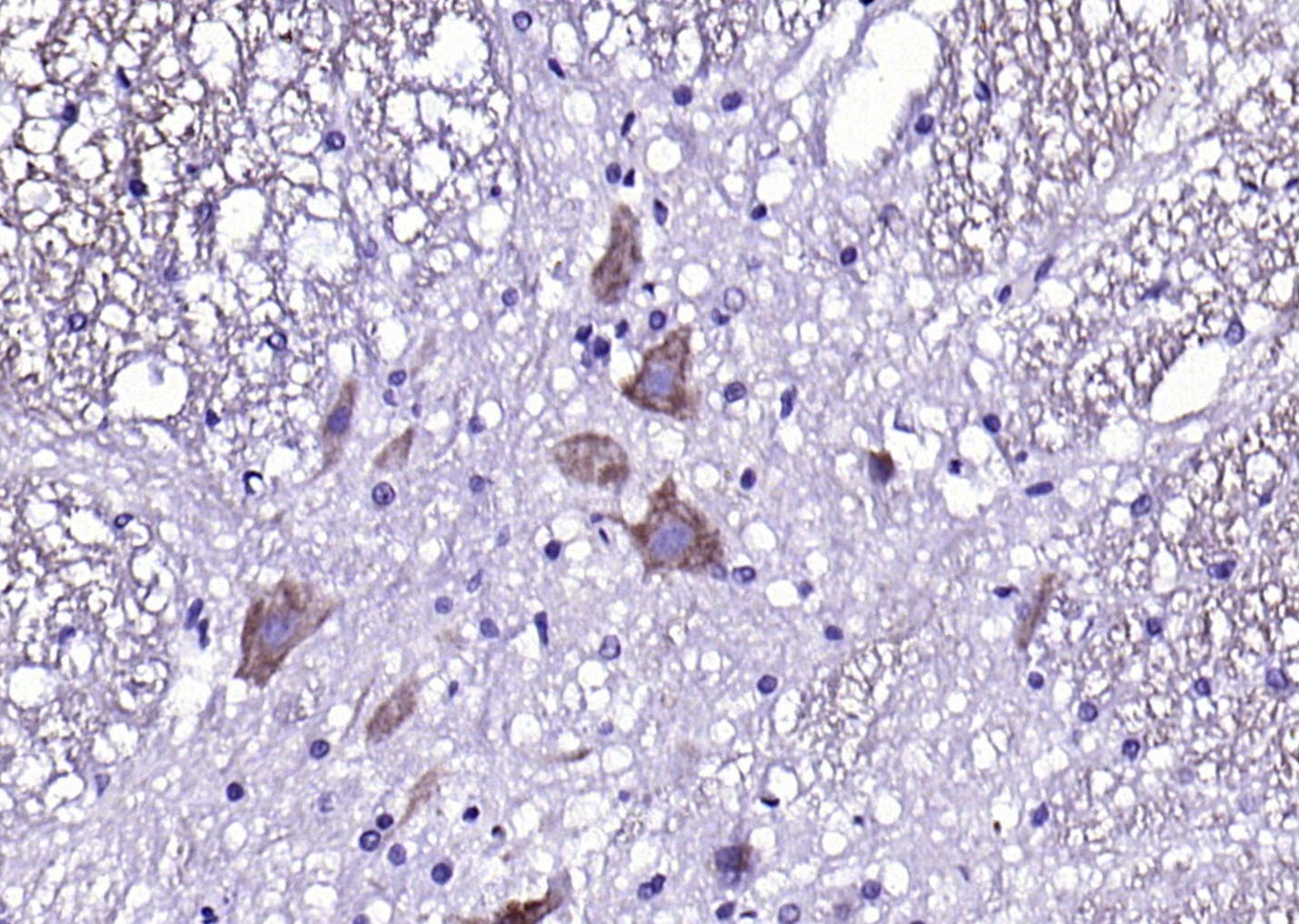 Anti-CX3CR1 Polyclonal Antibody