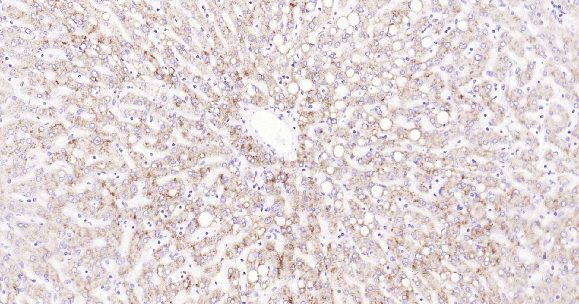 Anti-CYP7A1 Polyclonal Antibody 3