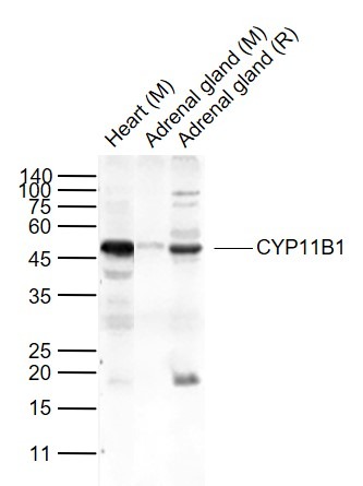Anti-CYP11B1 Polyclonal Antibody