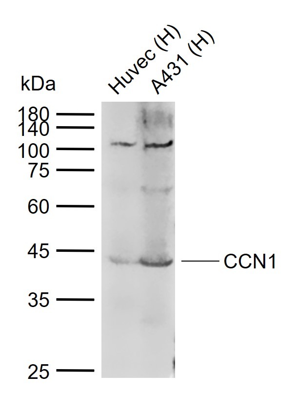 Anti-CYR61/CCN1 Polyclonal Antibody
