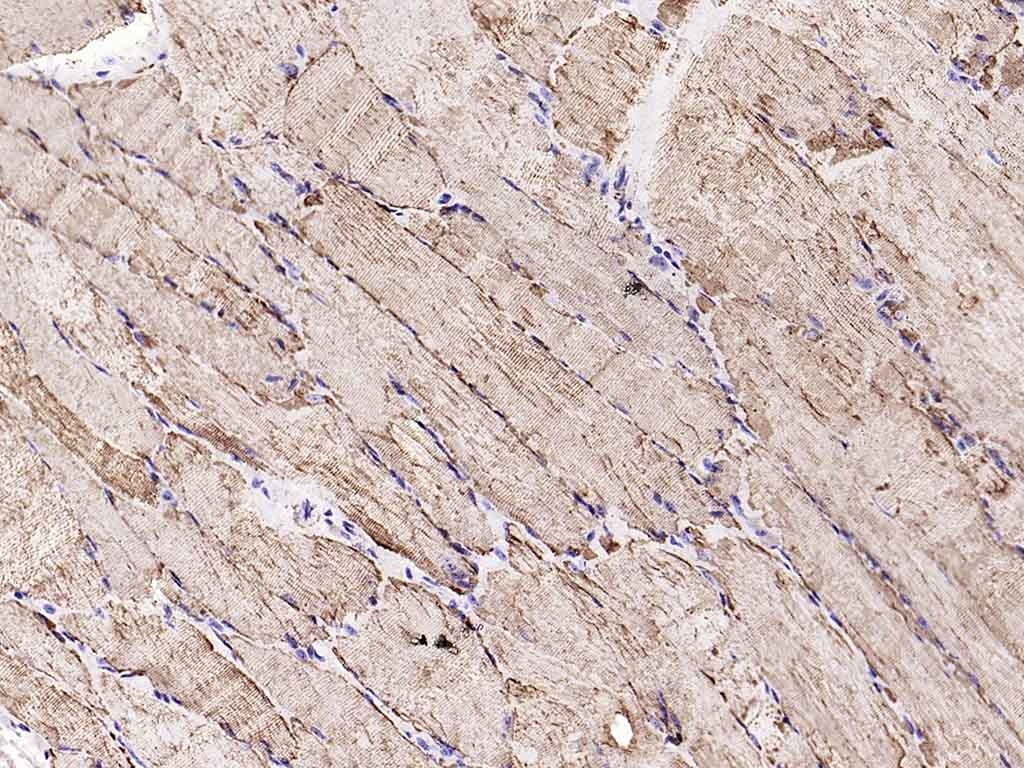 VDAC1 Mitochondrial Loading Control Antibody (5D173)