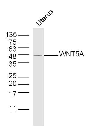 Anti-Wnt5a Polyclonal Antibody