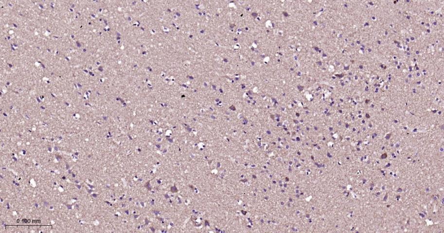 VDAC1 Mitochondrial Loading Control Antibody (5D173)
