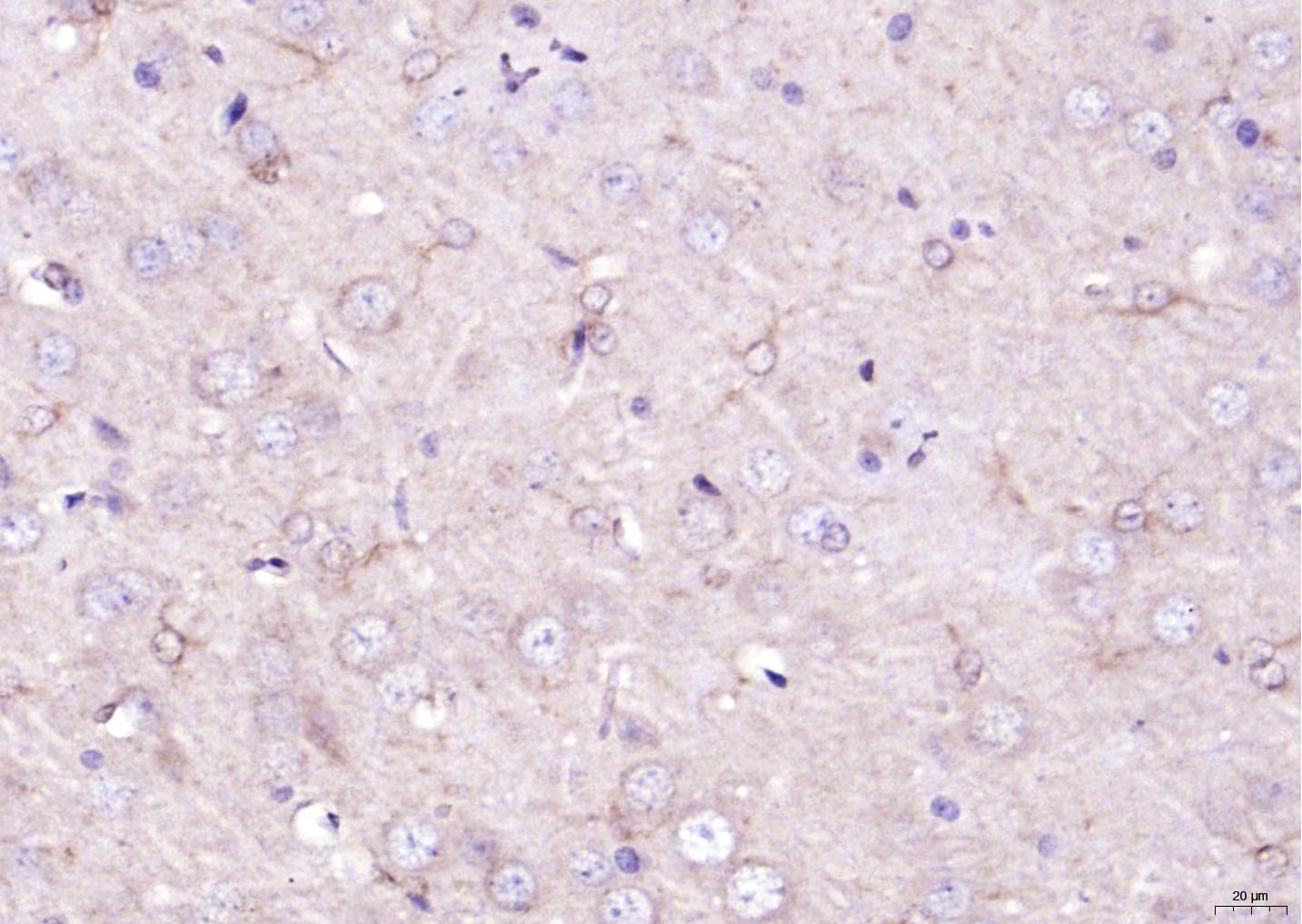 Anti-VCAN Polyclonal Antibody