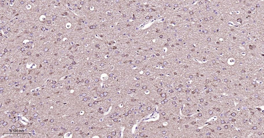 VDAC1 Mitochondrial Loading Control Antibody (5D173)