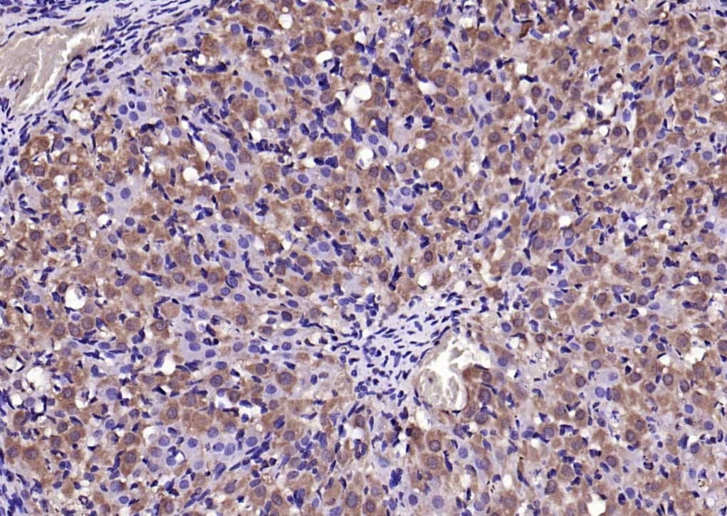 Anti-Wnt5a Polyclonal Antibody