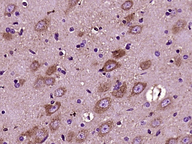 Anti-VCAN Polyclonal Antibody