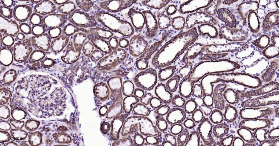 VDAC1 Mitochondrial Loading Control Antibody (5D173)