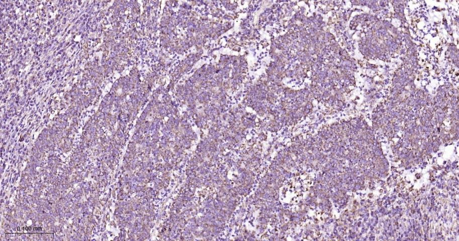 VDAC1 Mitochondrial Loading Control Antibody (5D173)