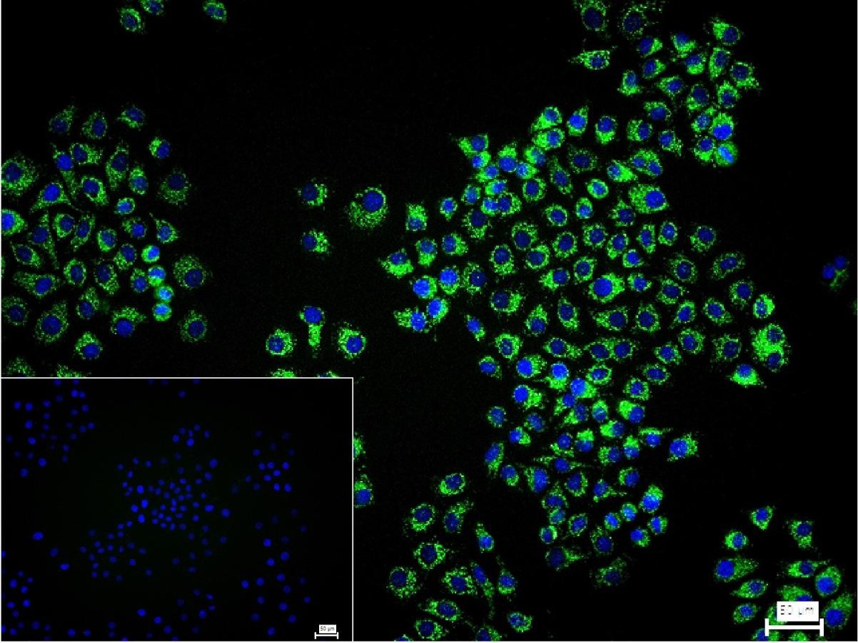 VDAC1 Mitochondrial Loading Control Antibody (5D173)