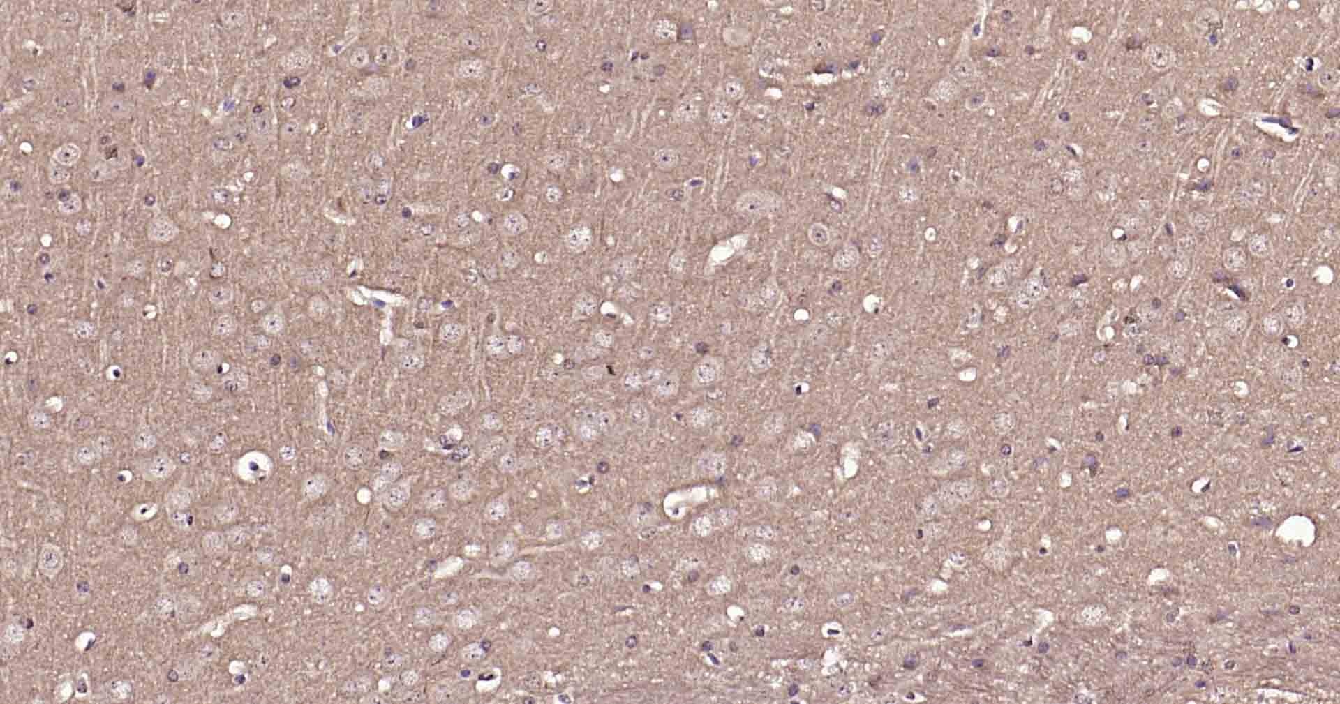 Anti-VGLUT1/BNP1 Polyclonal Antibody