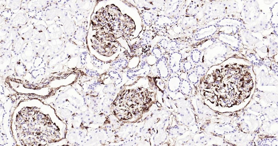 Anti-Vimentin Antibody (3C354)
