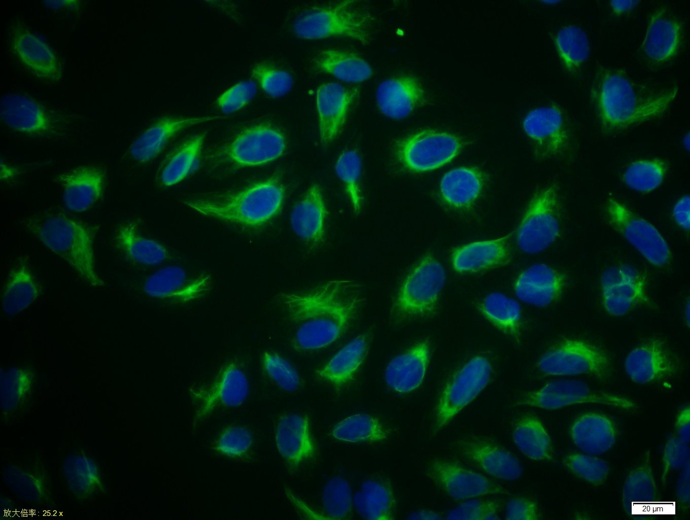 Anti-Vimentin Polyclonal Antibody