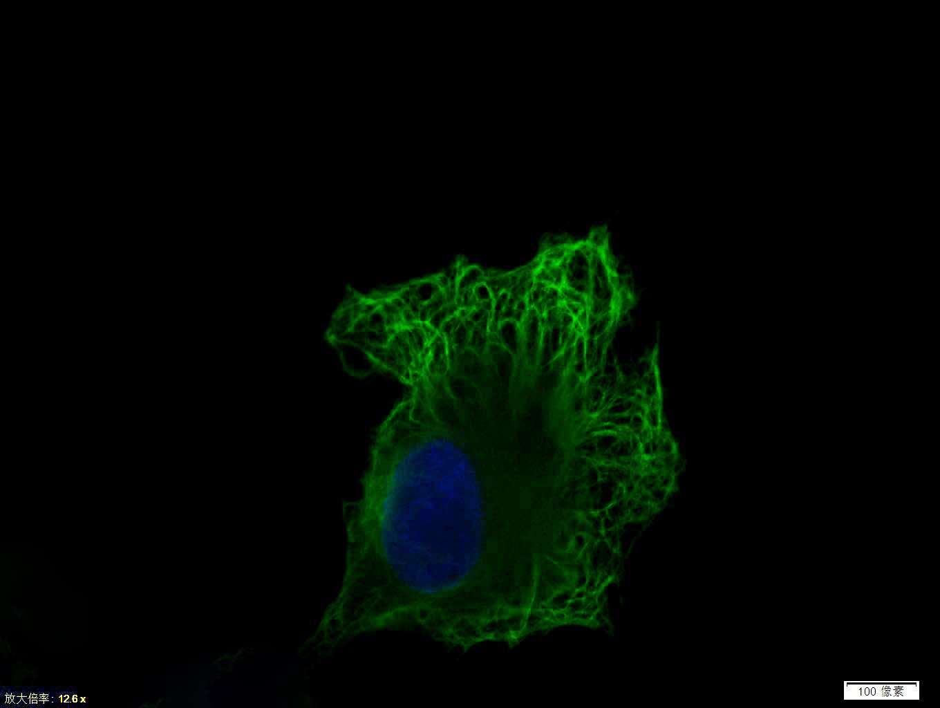 Anti-Vimentin Polyclonal Antibody