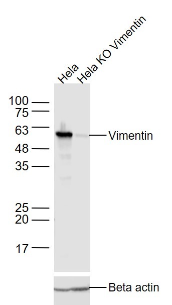 Anti-Vimentin Antibody (3C354)