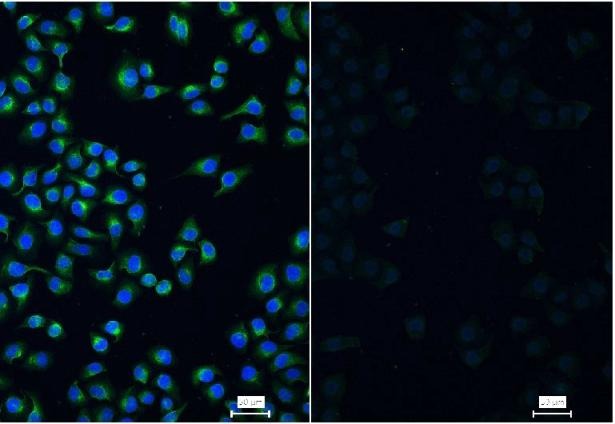 Anti-Vimentin Antibody (3C354)