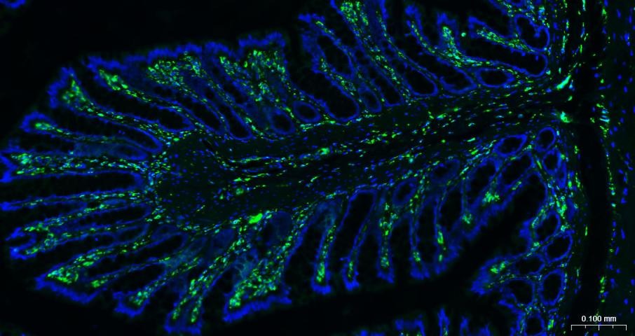 Anti-Vimentin Polyclonal Antibody