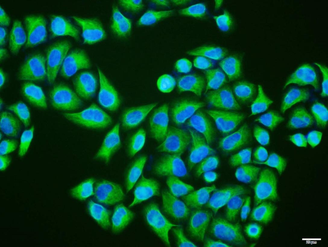 Anti-Vimentin Antibody (3C354)