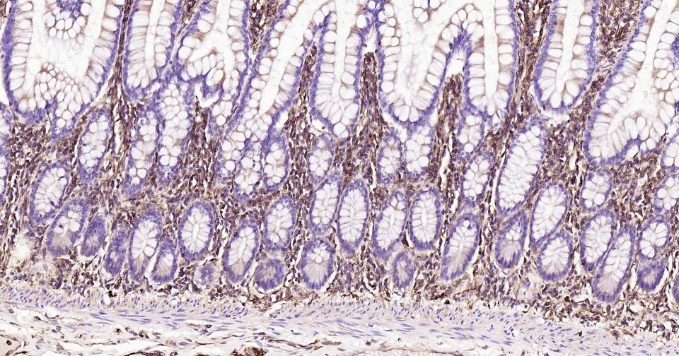 Anti-Vimentin Polyclonal Antibody 2