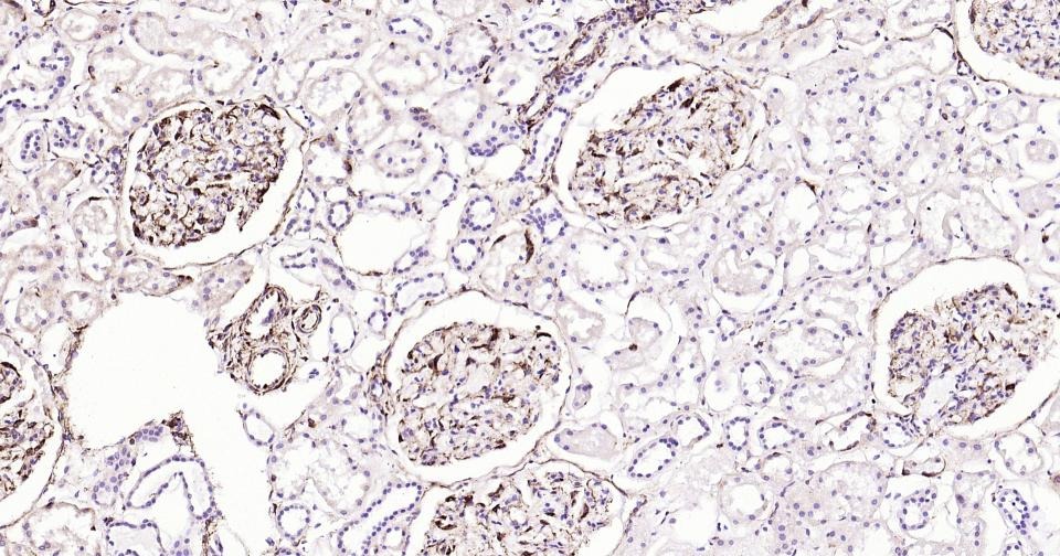 Anti-Vimentin Polyclonal Antibody 2